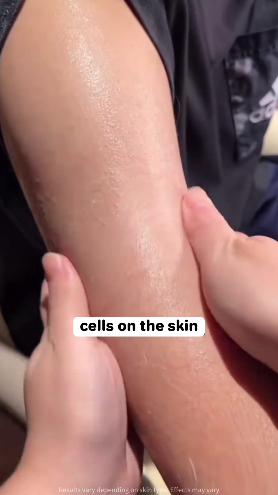 Finally, my skin became smoother.#skinever #skin #skincare #salicylicacid #lotion