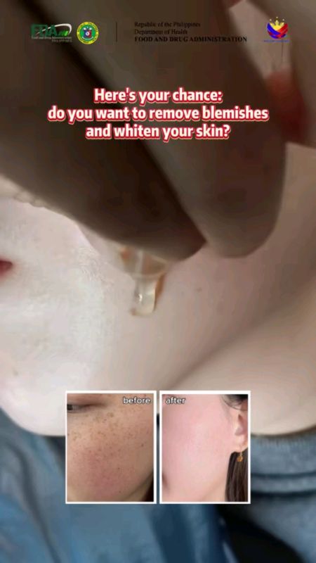 【Hot Sale】Teashell Whitening Serum 5% Niacinamide & Alpha Arbutin 30ml - Fade Dark Spots Brighte