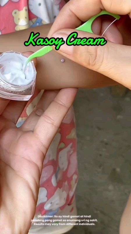 NATURE'S MIRACLE KASOY CREAM #freecoinsashoppevideo #fyp #AngDaliDaliSaShopee