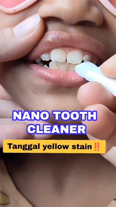 [3PCS] Nano Teeth Whitening Eraser - Instant Tartar & Plaque Remover, for Kids & Adults #Shopee33InstantSurprise #ShopeePHPaydaySale #HugotSaShopee