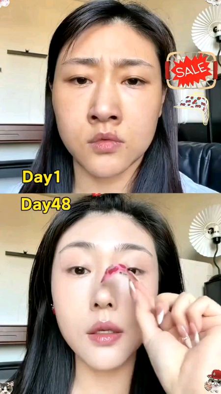 Shaping Nose Strip Nose Strips Self adhesive  Nose Shrinking Patch Reusable #noseline #pampatangos #shapingnose #nosepatch #Noselift