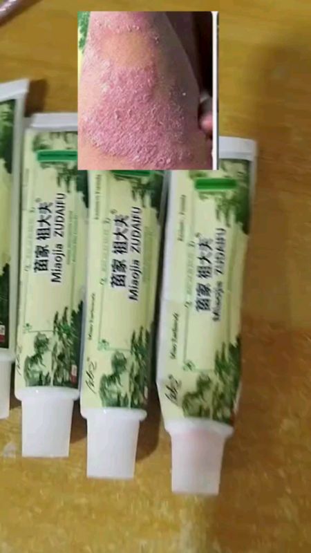 ## MiaoJiaZDFskin Herbal Psoriasis Dermatitis Eczema ointment #Benshops#masmurasashopee#makeitviral#fyp#shopeebudol#flashsale#6.6#megasale