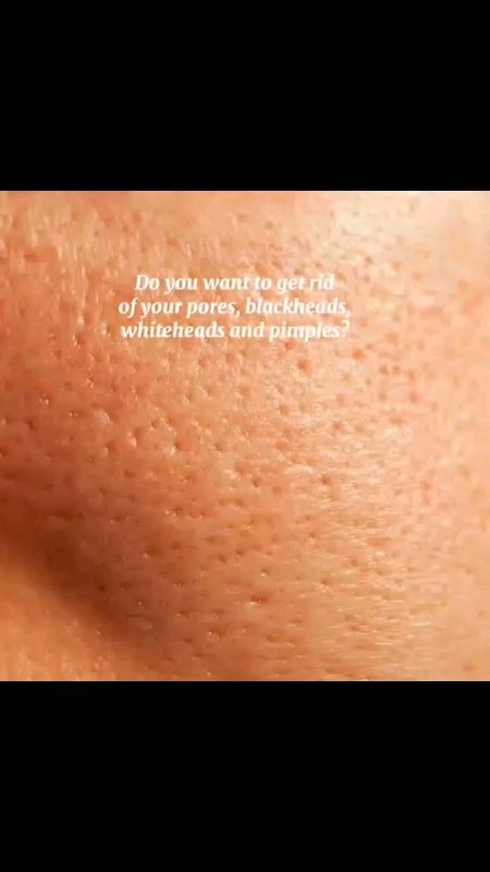 #Duet with ch3eee  Salicylic Acid Pore Refining Serum Moisturizing Nourishing Firming Whitening Anti-Aging Anti-Wrinkle Facial Skin Care