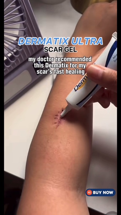 Dermatix Scar Gel Acne Scar Treatment Scar Remover effective 15g Imports Acne Old ultra Scar Remover #scargel #scarremover #scar #acne